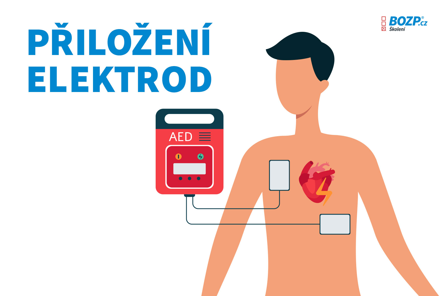 Místa, kam na lidské tělo přiložit elektrody defibrilátoru (AED)