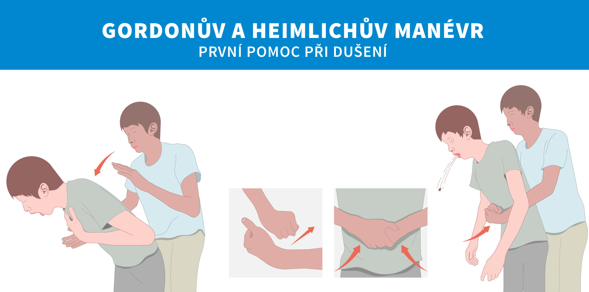 Co delat kdyz se nekdo dusi zvratky?